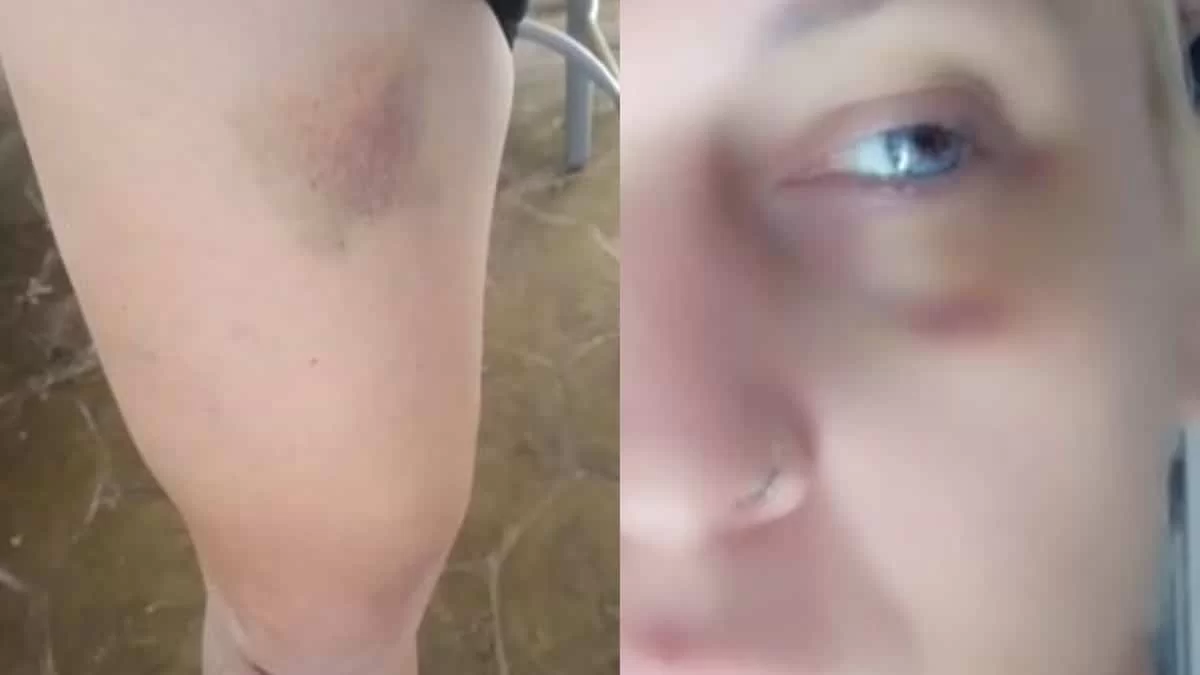 «Με χτύπησαν παντού, στον λαιμό, στα πλευρά» - Συγκλονίζει η τρανς, πρώην παίκτρια του Game of Chefs για τον ξυλοδαρμό της