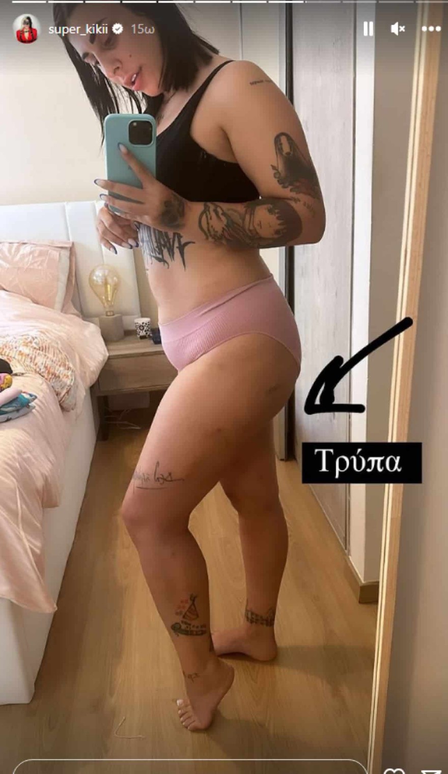 Super Κική - Λιποαναρόφηση