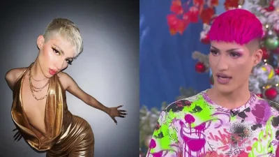 Θέμης Κανέλλος: Έβαλε υαλουρονικό στα οπίσθιά του - Αυτή είναι η νέα του εικόνα