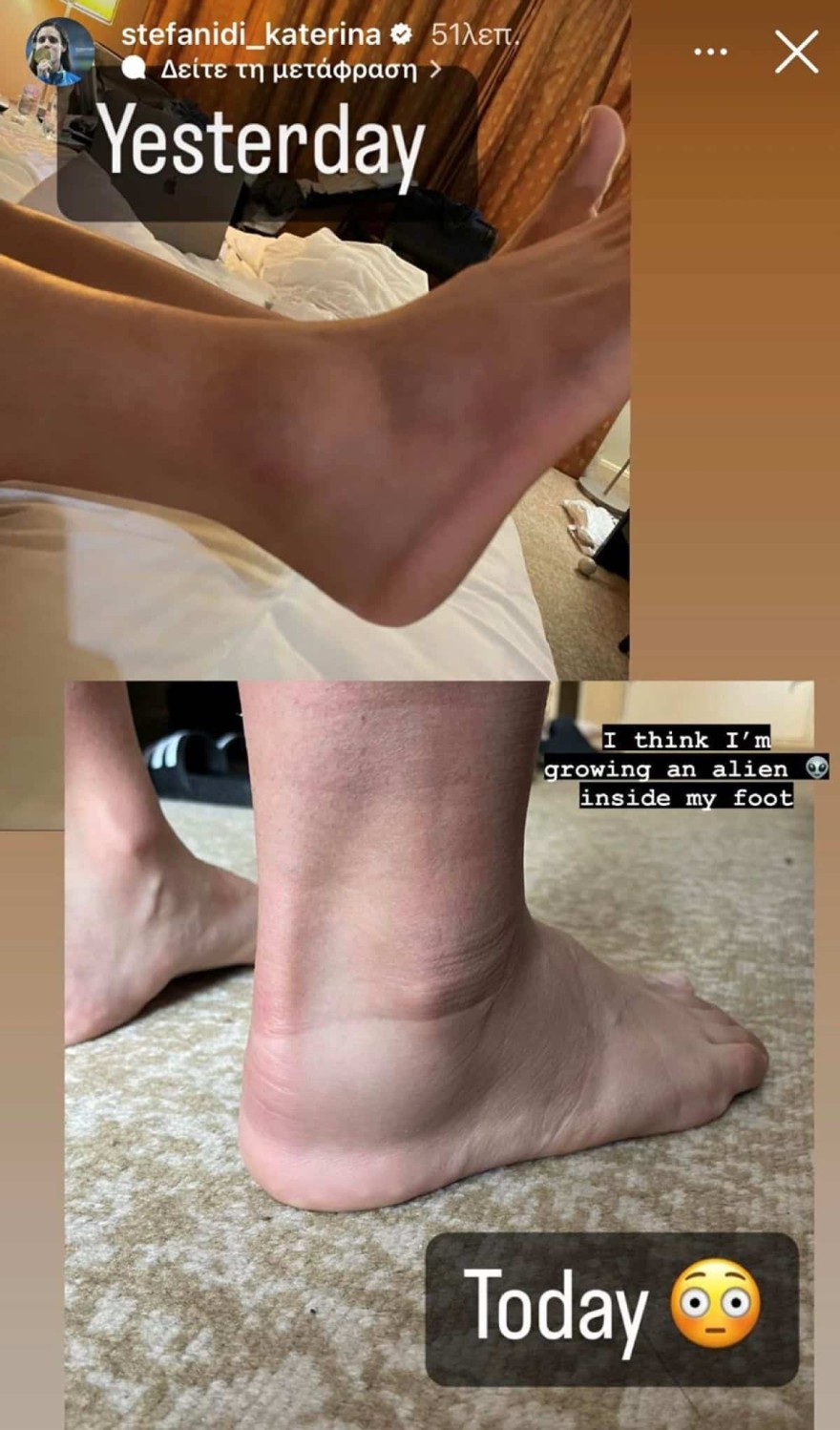Κατερίνα Στεφανίδη τραυματισμός