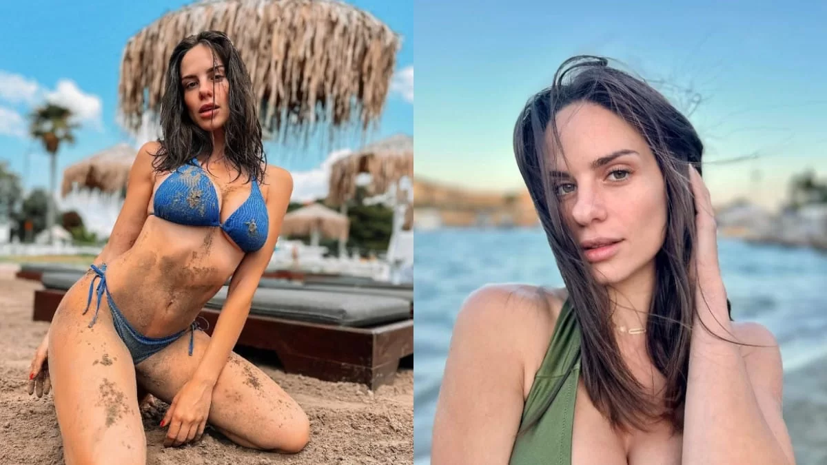 «Τα είχα πειράξει λίγο, δεν θα πω μαλ@κια@» - Η αποκάλυψη της Σοφίας Φυρού για τις πλαστικές στο πρόσωπο και το σώμα της