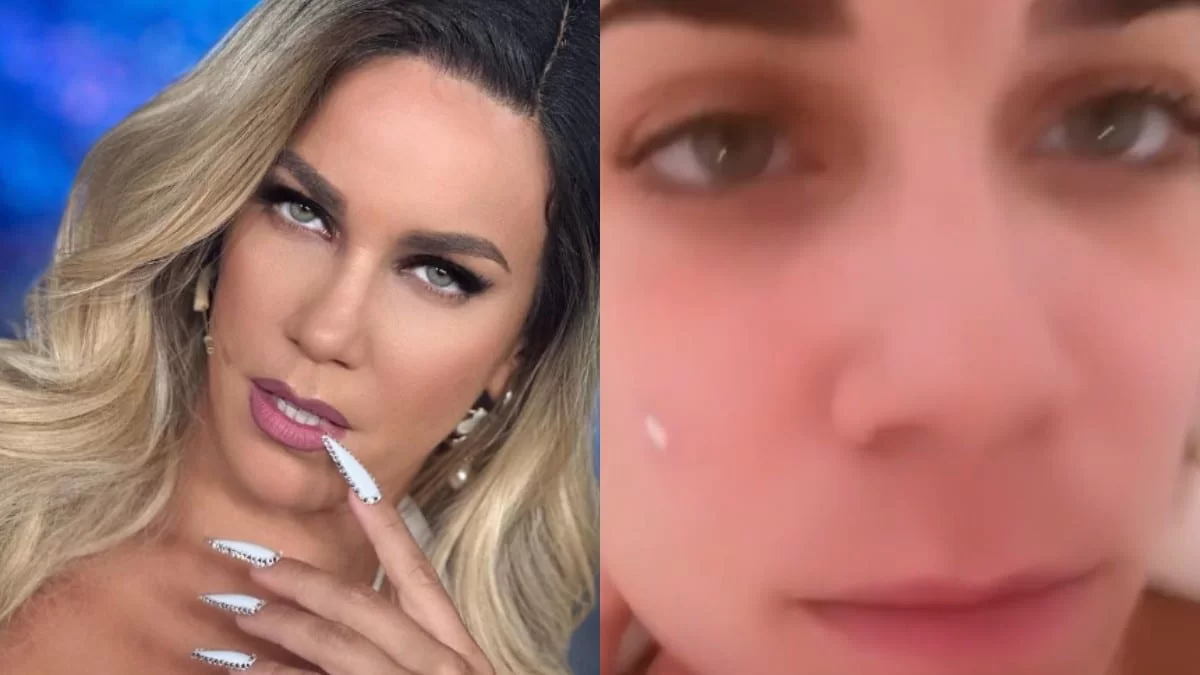 «Με νευριάζει, με τρελαίνει, θέλω να πάρω ένα ψαλίδι...» - Η Κατερίνα Στικούδη έδειξε το αληθινό της πρόσωπο χωρίς μακιγιάζ με το σημάδι από το σπυράκι της (Βίντεο)