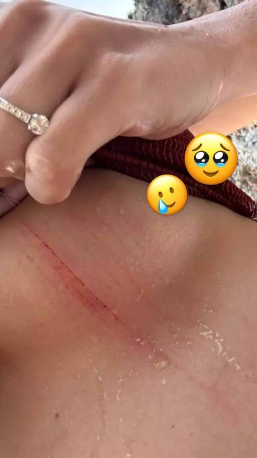 Ιωάννα Τούνη ατύχημα