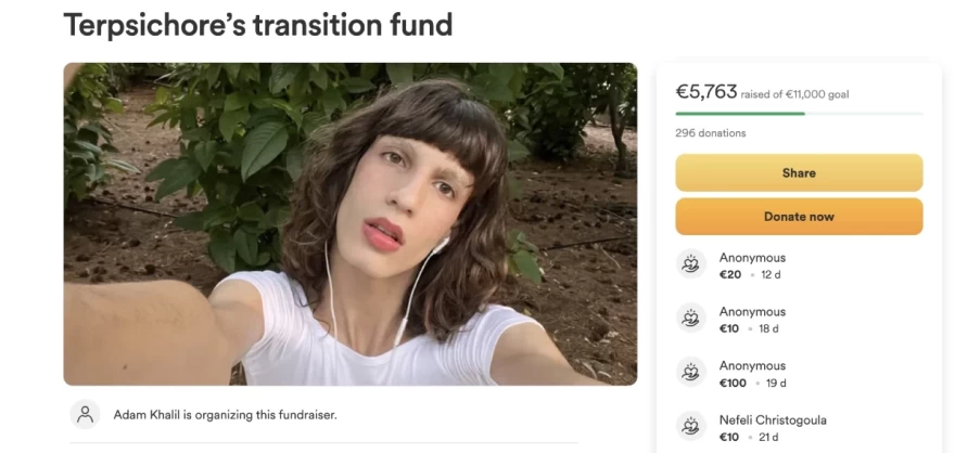 Παίκτης GNTM αλλαγή φύλου