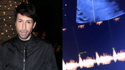 Πατέρας για πρώτη φορά ο Κωνσταντίνος Εμμανουήλ: «Είναι δυο μηνών;» - Βίντεο με το υπερηχογράφημα