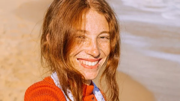 Φακίδες στο πρόσωπο: Πώς από ψεγάδι της επιδερμίδας έγινε το απόλυτο beauty trend στο ΤικΤοκ!