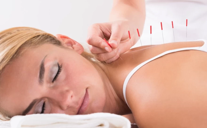 θεραπεία βελονισμού