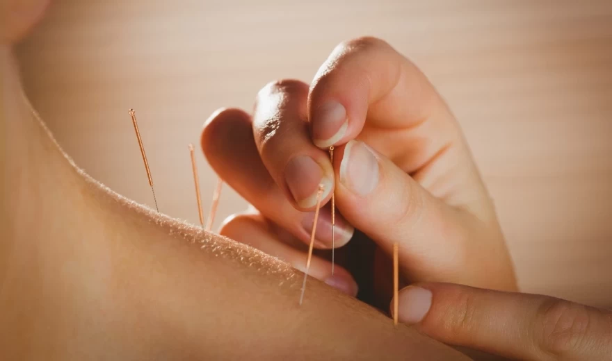 βελονισμός στον ώμο