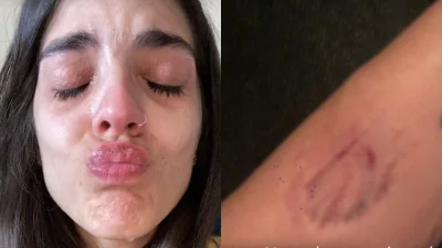 Άννα Μαρία Βέλλη: Νέα ανάρτηση με σοκαριστικά ντοκουμέντα από την άσχημη σωματική κακοποίηση που υπέστη