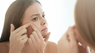 Σπυράκια στο πρόσωπο: Με αυτά τα κόλπα θα τα εξαφανίσεις ανέξοδα και με τον πιο φυσικό τρόπο!