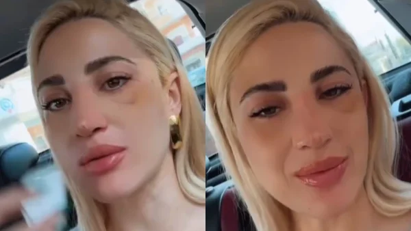 Ιωάννα Τούνη: «Δεν έχω κάτι χειρότερο» - Η αγωνία μετά την επέμβαση στη μύτη και τα χάπια που πρέπει να πάρει