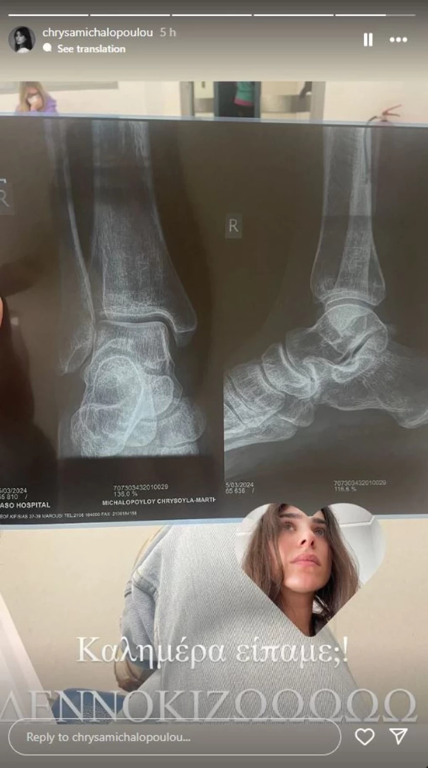 ΑΝΑΡΤΗΣΗ ΧΡΥΣΑ ΜΙΧΑΛΟΠΟΥΛΟΥ