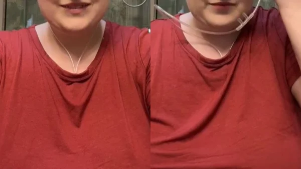 Διάσημη Τικ Τόκερ πέθανε από μεταστατικό σάρκωμα σε ηλικία 31 ετών - «Γεια σας followers, αν βλέπετε αυτό το μήνυμα, πέθανα γαλήνια»