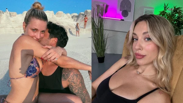 Γαρυφαλλιά Καληφώνη: Το αυτοάνοσο που ταλαιπωρεί την σύντροφο του Χρήστου Μάστορα - Φωτογραφίες ντοκουμέντο