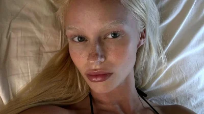 Αυτό το lip balm της Kiko Milano είναι το Νο1 προϊόν στο TikTok — Κοστίζει μόνο 7,49€