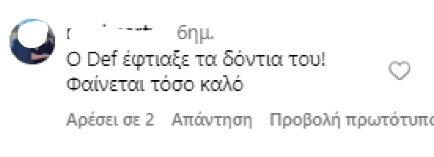 Σχόλιο για τα δόντια του Johnny Depp