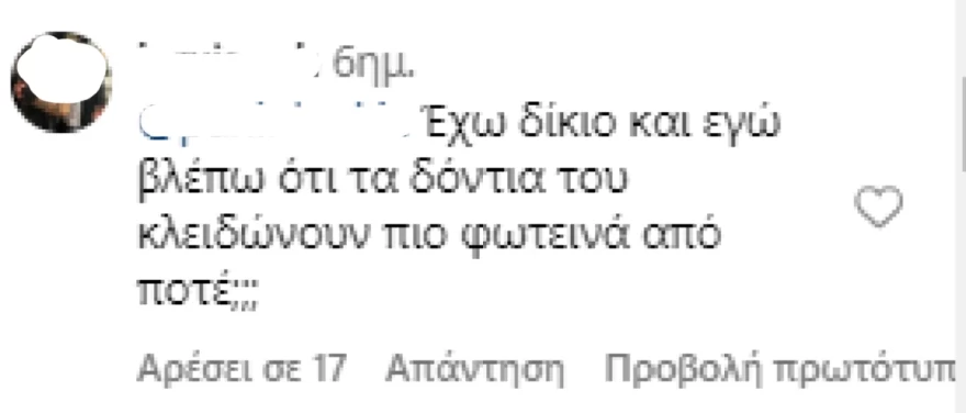 Σχόλιο για τα δόντια του Τζόνι Ντεπ