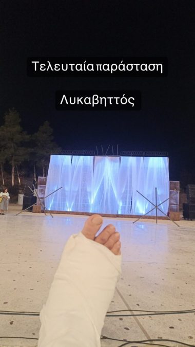 Ο Άκης Σακελλαρίου με το πόδι στο γύψο, στο θέατρο Λυκαβηττού