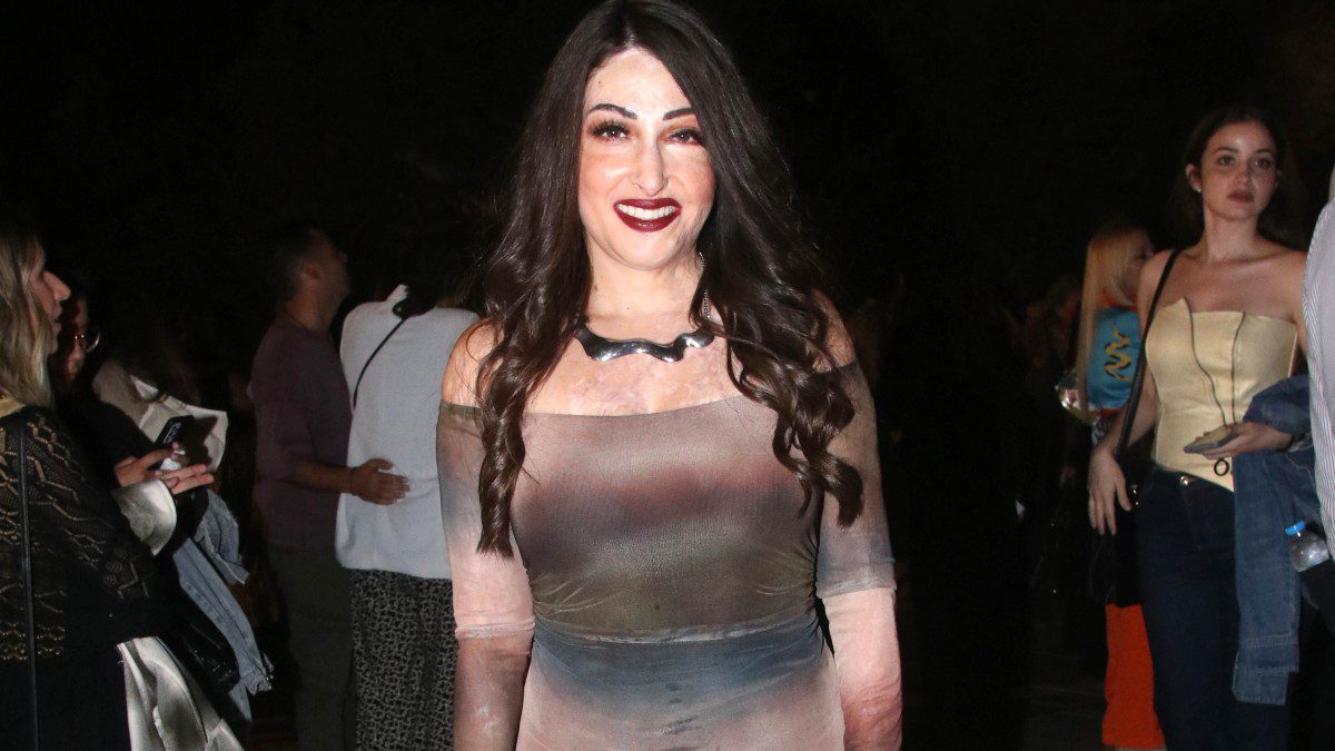 Ιωάννα Παλιοσπύρου - H αποκάλυψη για την ζωή με αναπηρία: «Ίσως δεν το καταλαβαίνετε...»