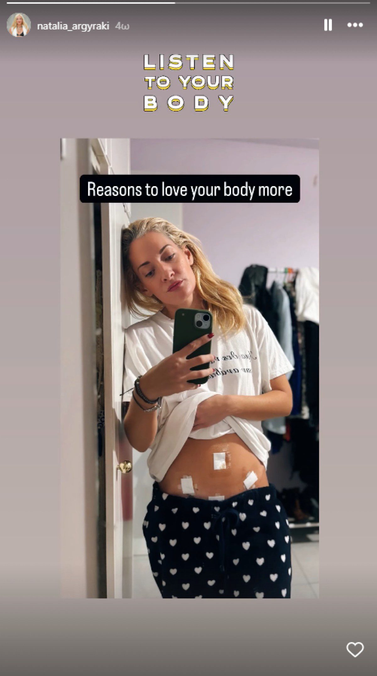 Η Ναταλία Αργυράκη μετά την επέμβαση που έκανε