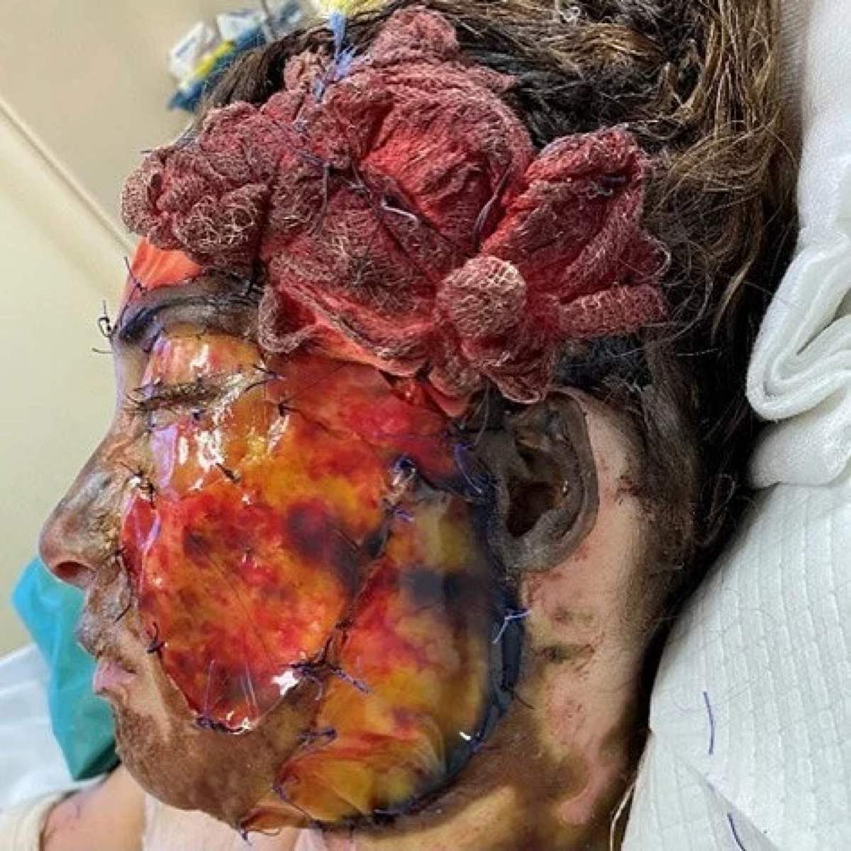 Το πρόσωπο της Ιωάννας Παλιοσπύρου μετά την επίθεση