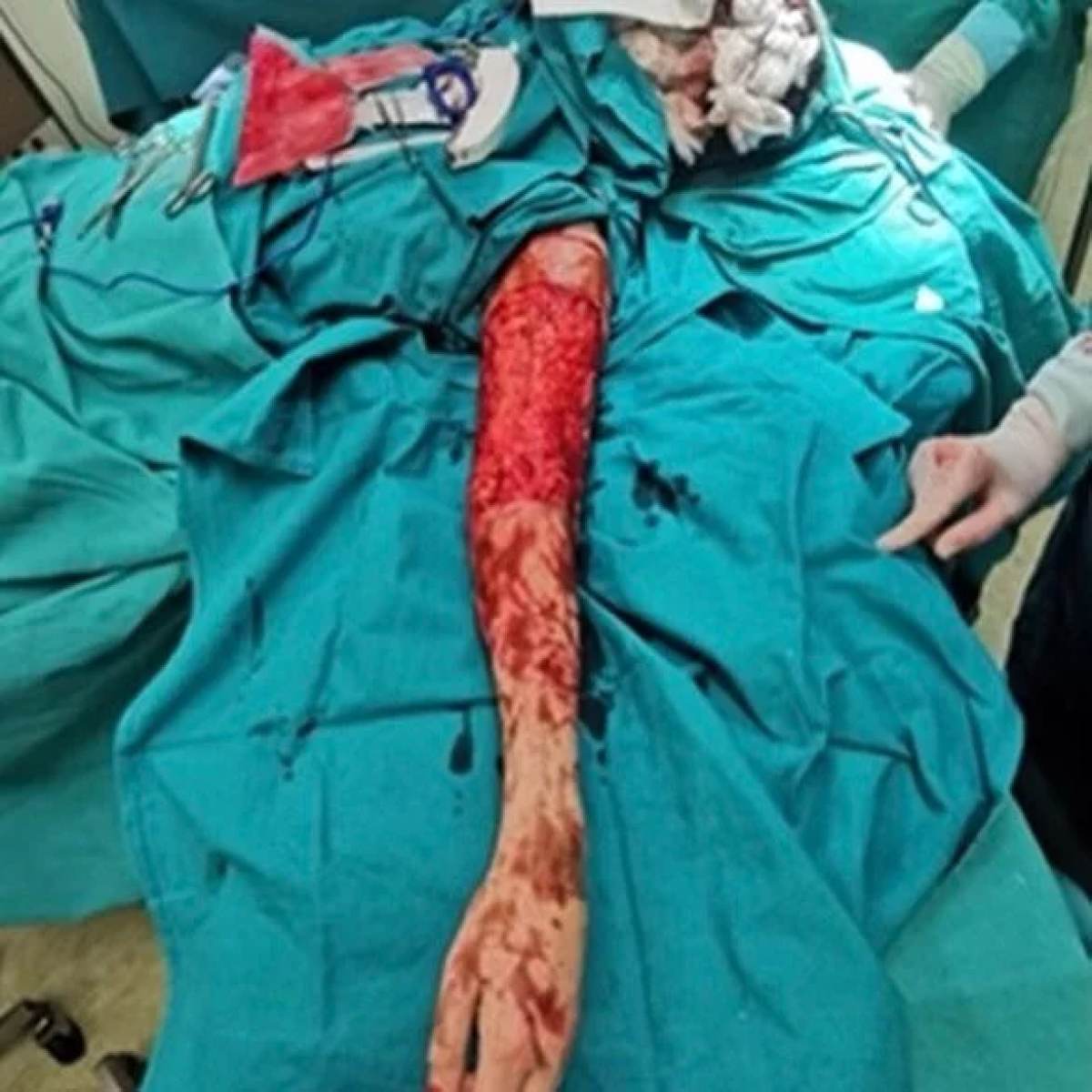 Το σώμα της Ιωάννας Παλιοσπύρου μετά την επίθεση