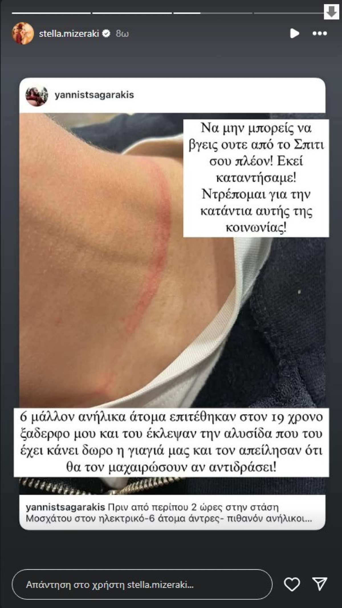 Στέλλα Μιζεράκη: Επίθεση στον 19χρονο ξάδερφο της - Ανατριχιαστικές φωτογραφίες