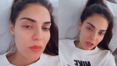 Η Βρισηίδα Ανδριώτου με πρησμένο μάτι