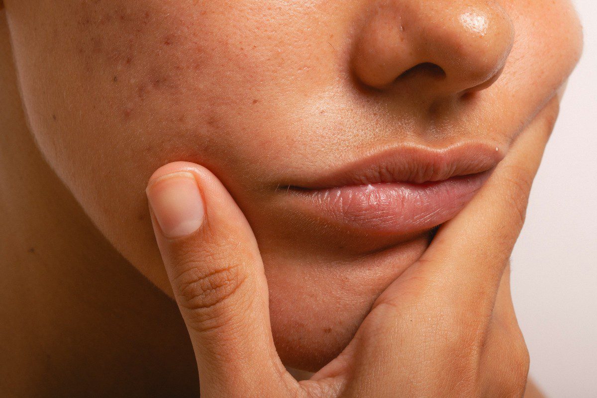 μια κοπέλα με αφυδατωμένο πρόσωπο