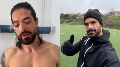 Ο Άρης Μουγκοπέτρος μετά και πριν το ατύχημα με την κροτίδα