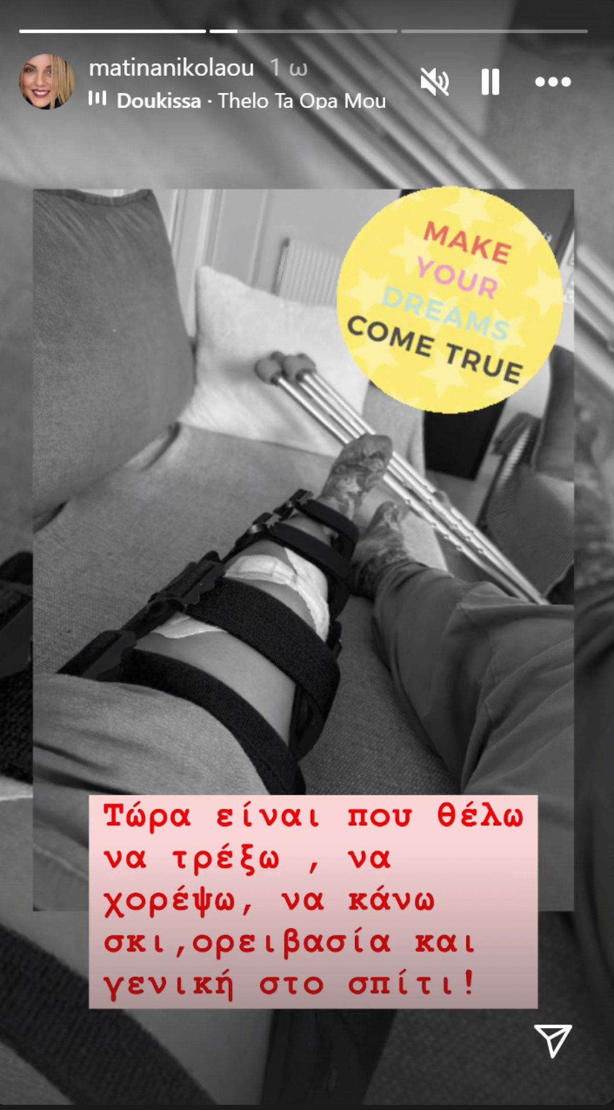 το πόδι της Ματίνας Νικολάου ανάρτηση σε νάρθηκα