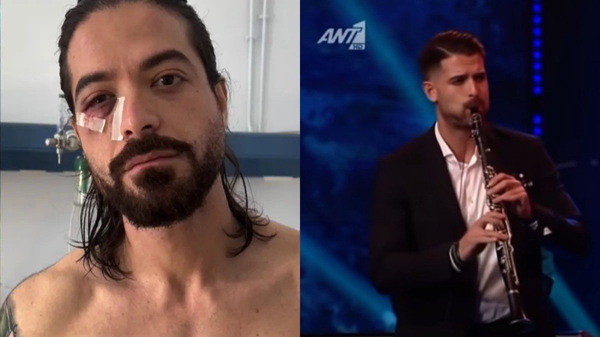 Άρης Μουγκοπέτρος