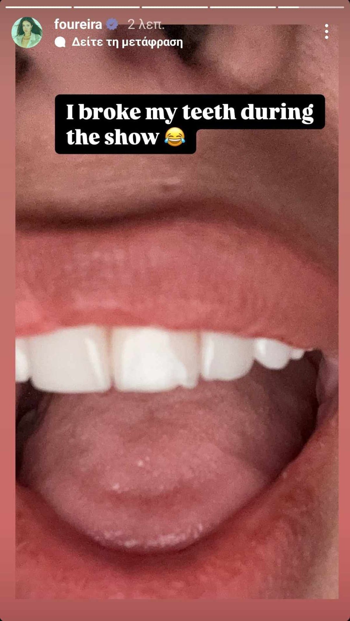 Ελένη Φουρέιρα δόντι