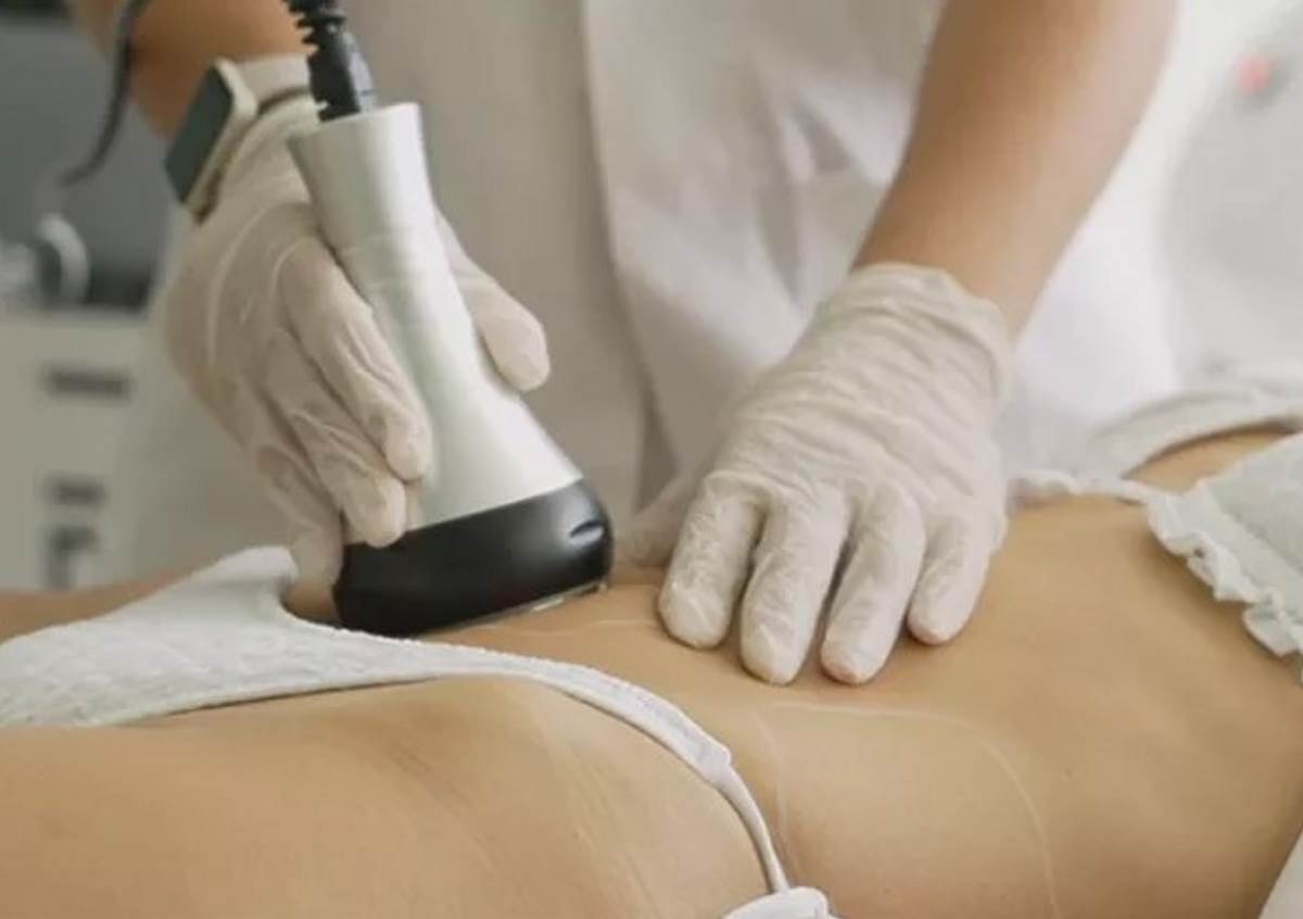 τοπικό αδυνάτισμα λιποδιάλυση