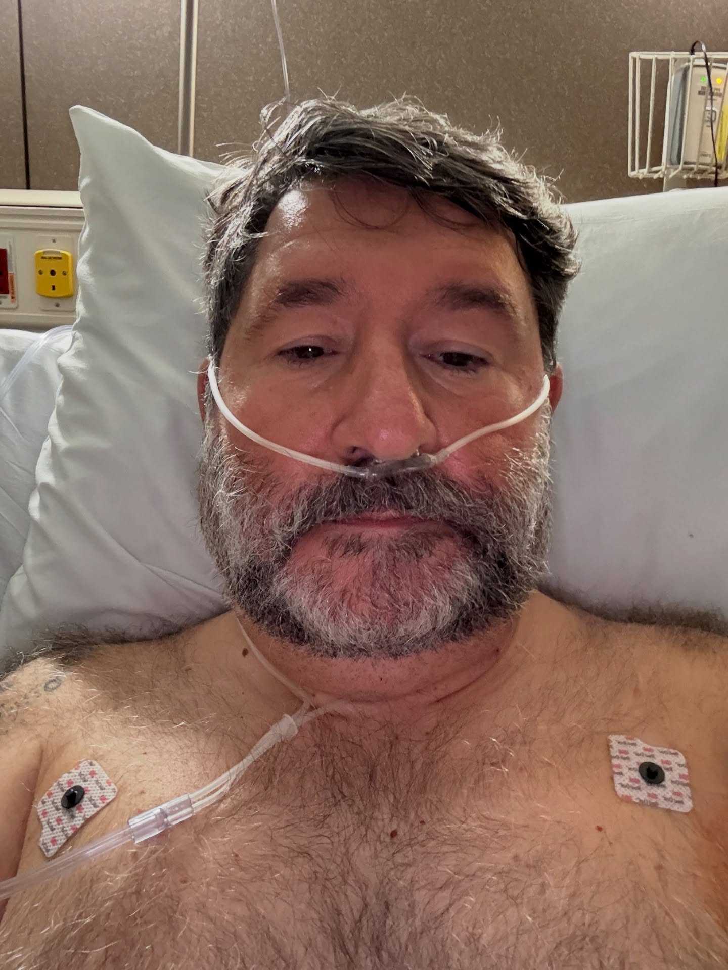 Γιάννης Μπουροδήμος: Ο πρώην παίκτης του MasterChef διαγνώστηκε με καρκίνο του πνεύμονα – «Πονάω αρκετά»