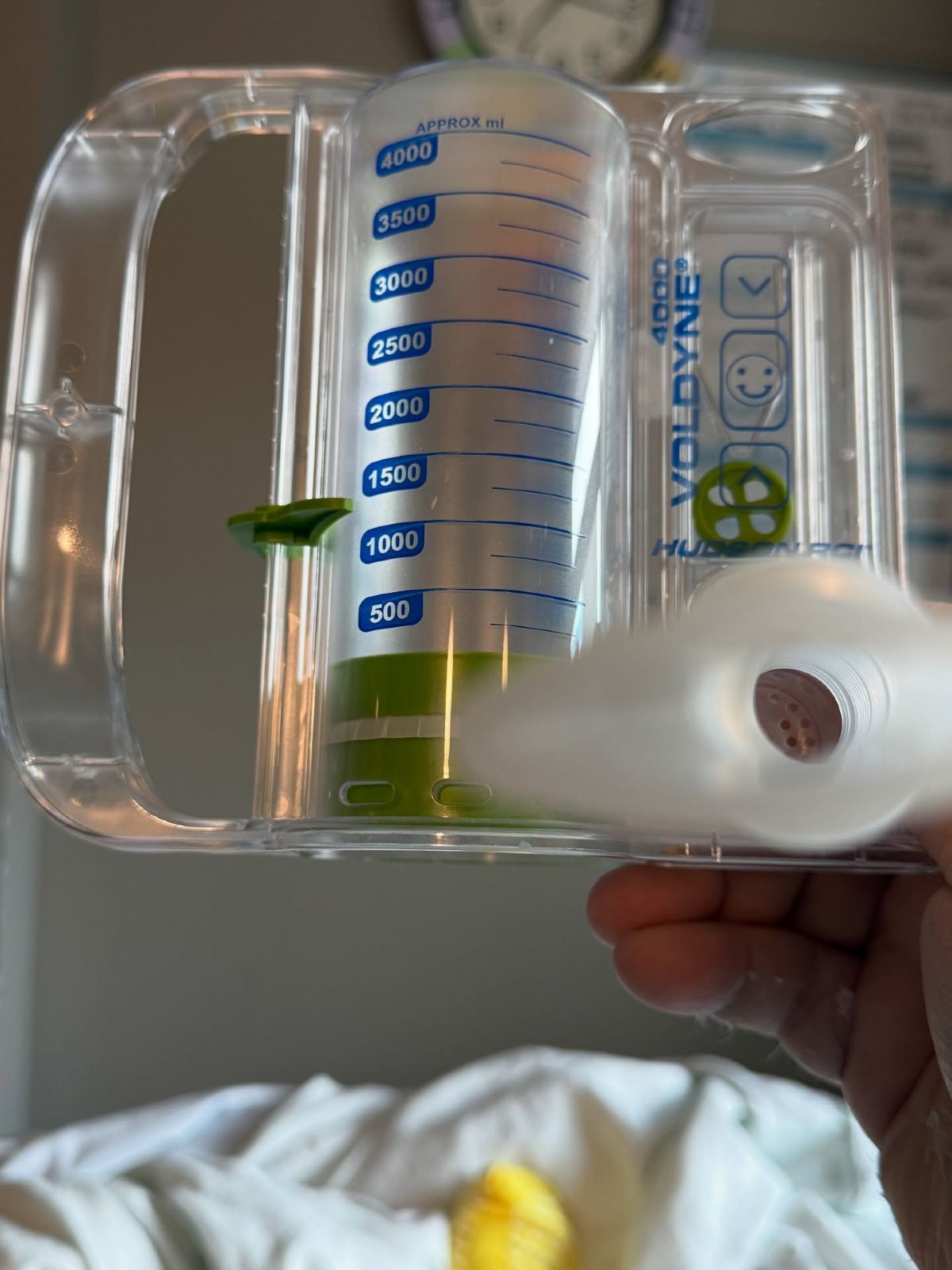 Γιάννης Μπουροδήμος: Ο πρώην παίκτης του MasterChef διαγνώστηκε με καρκίνο του πνεύμονα – «Πονάω αρκετά»