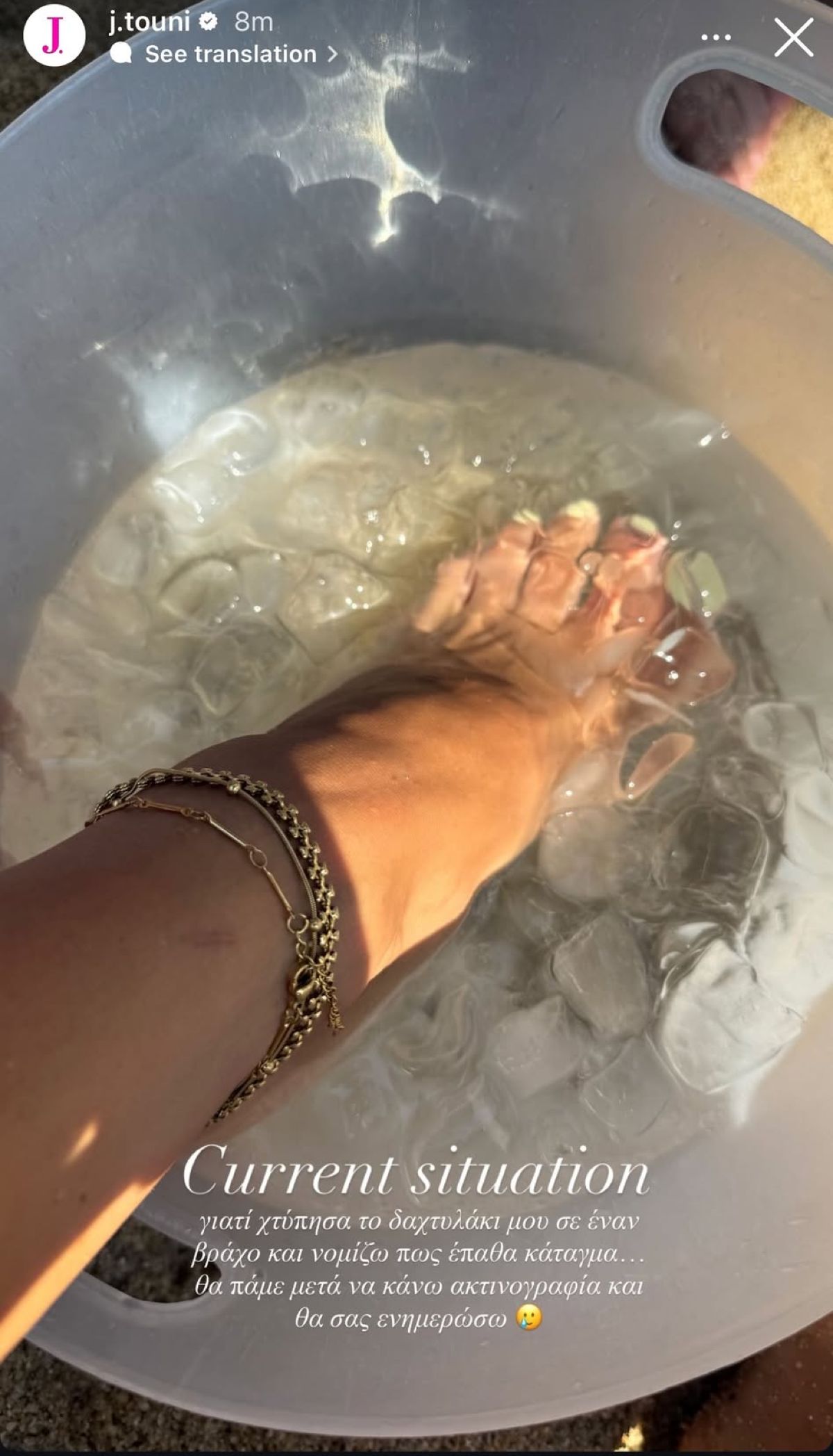 Ατύχημα για την Ιωάννα Τούνη: «Χτύπησα, θα πάω να κάνω ακτινογραφία»