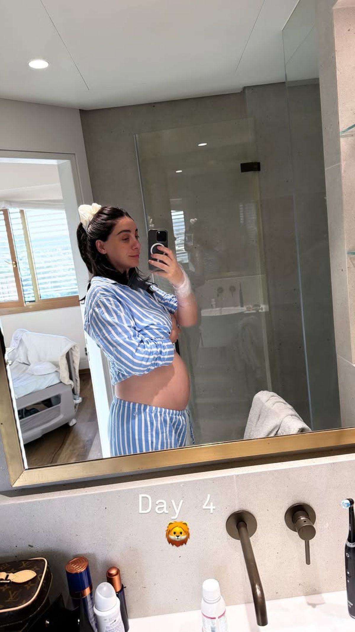 Το σώμα της Βαλέριας Χοψονίδου 4 μέρες μετά τη γέννα 