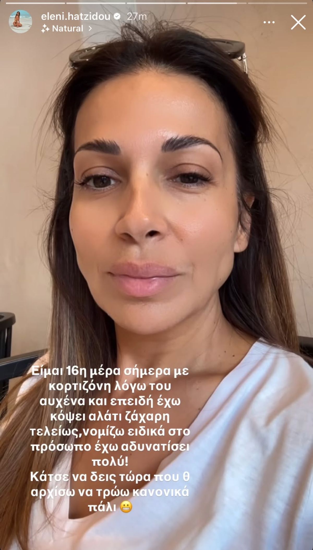 Η Ελένη Χατζίδου μετά από 16 μέρες κορτιζόνη
