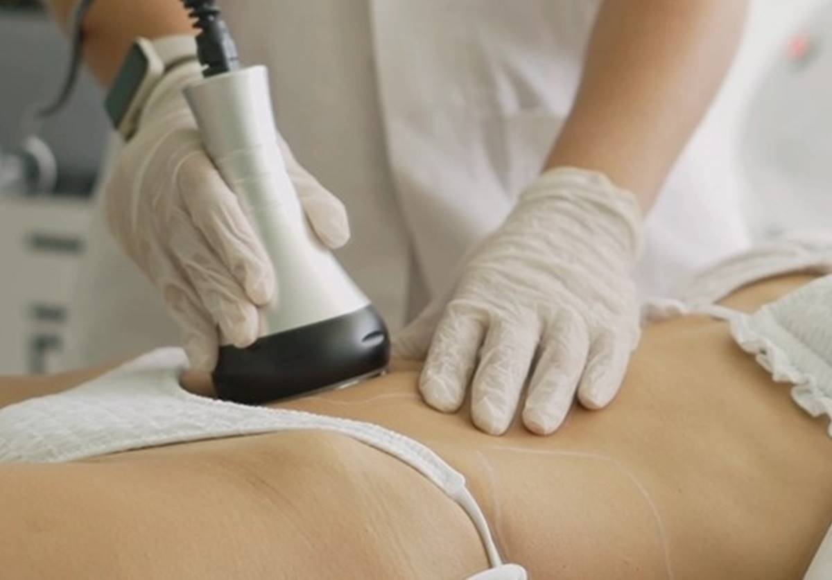 λιπογλυπτική σώματος medicosmetic