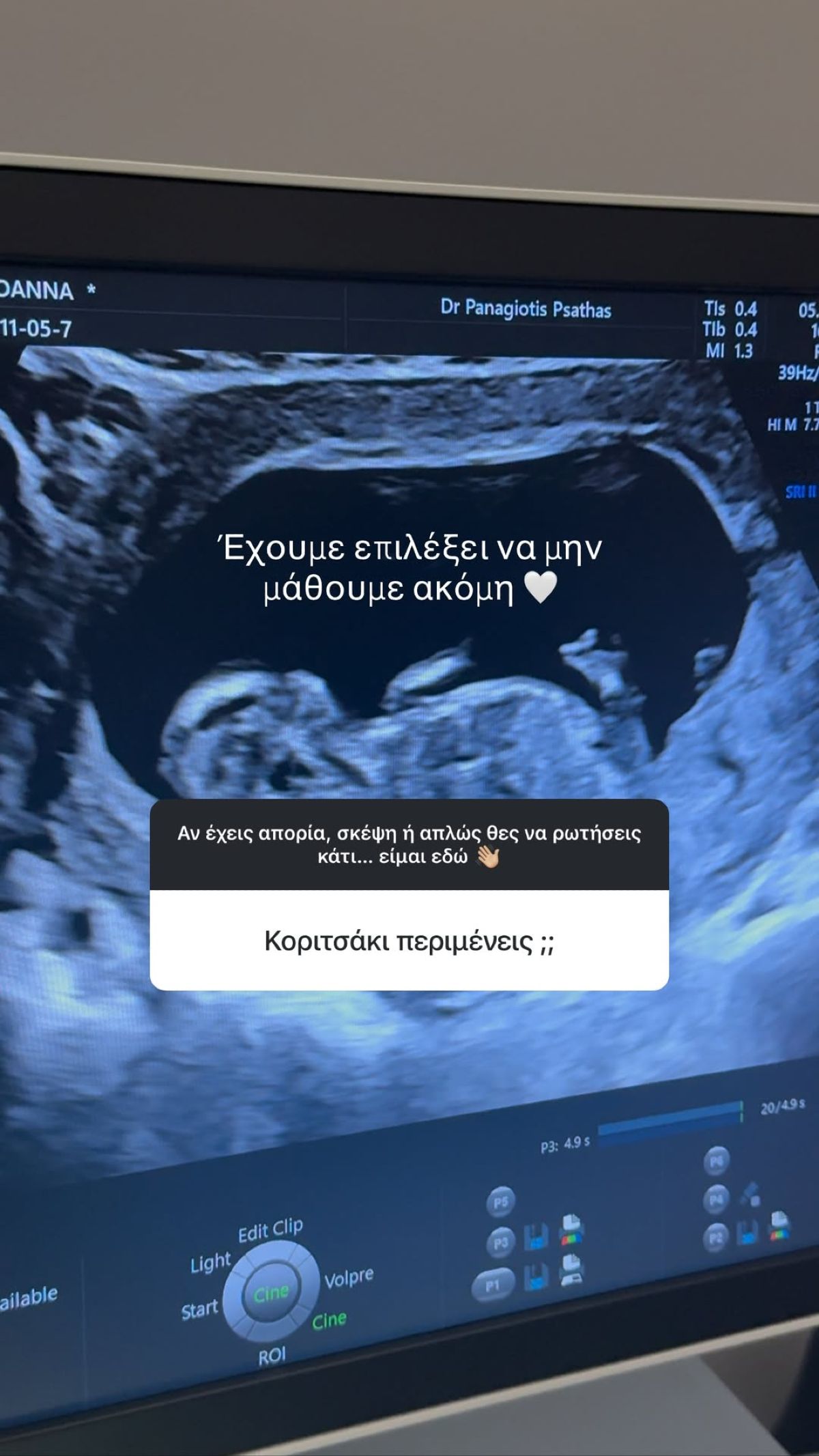 Η Ιωάννα Σιαμπάνη στο Instagram