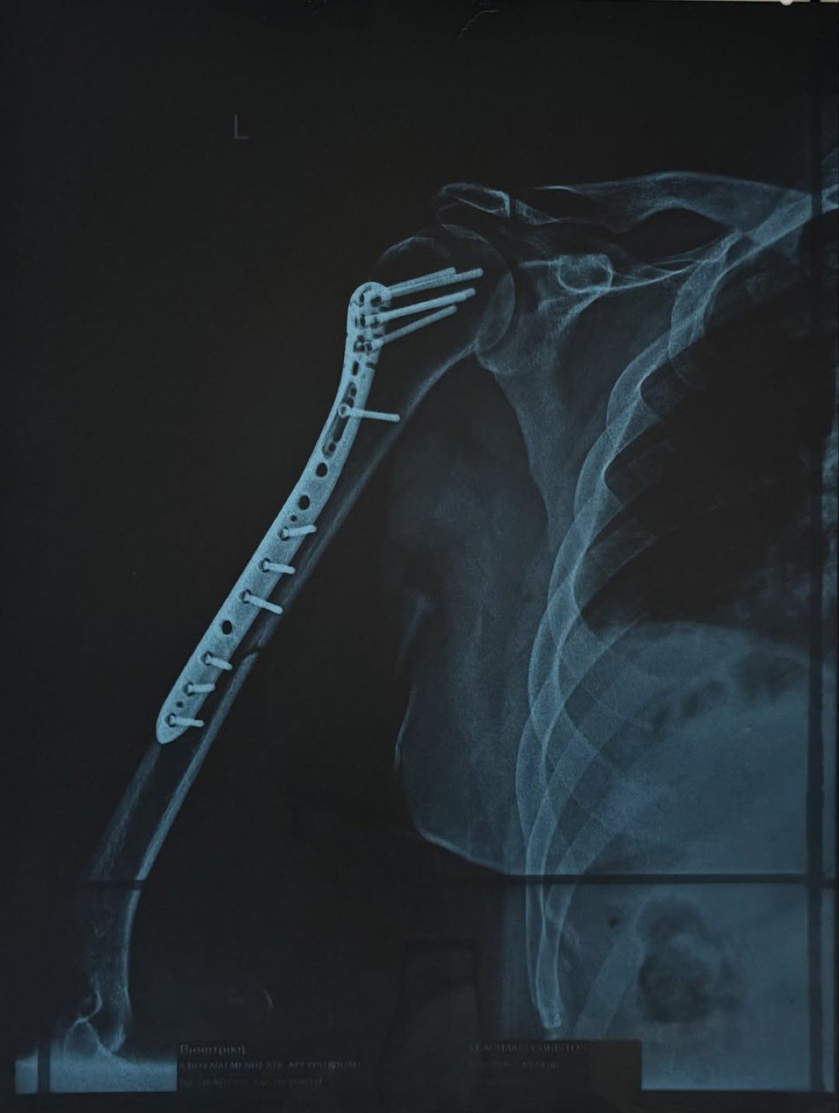 Χρήστος Δάντης χέρι