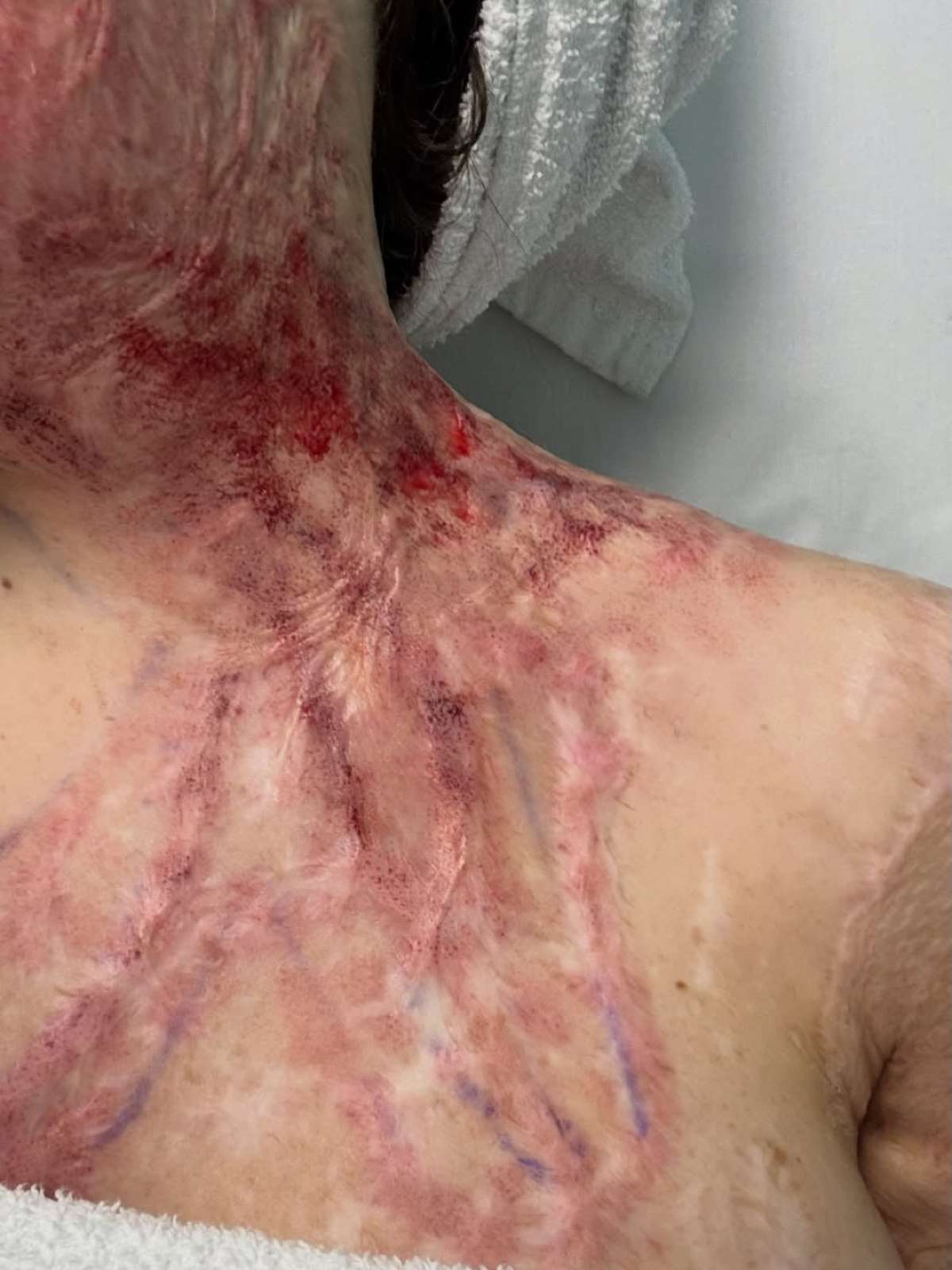 Παλιοσπύρου σημάδια