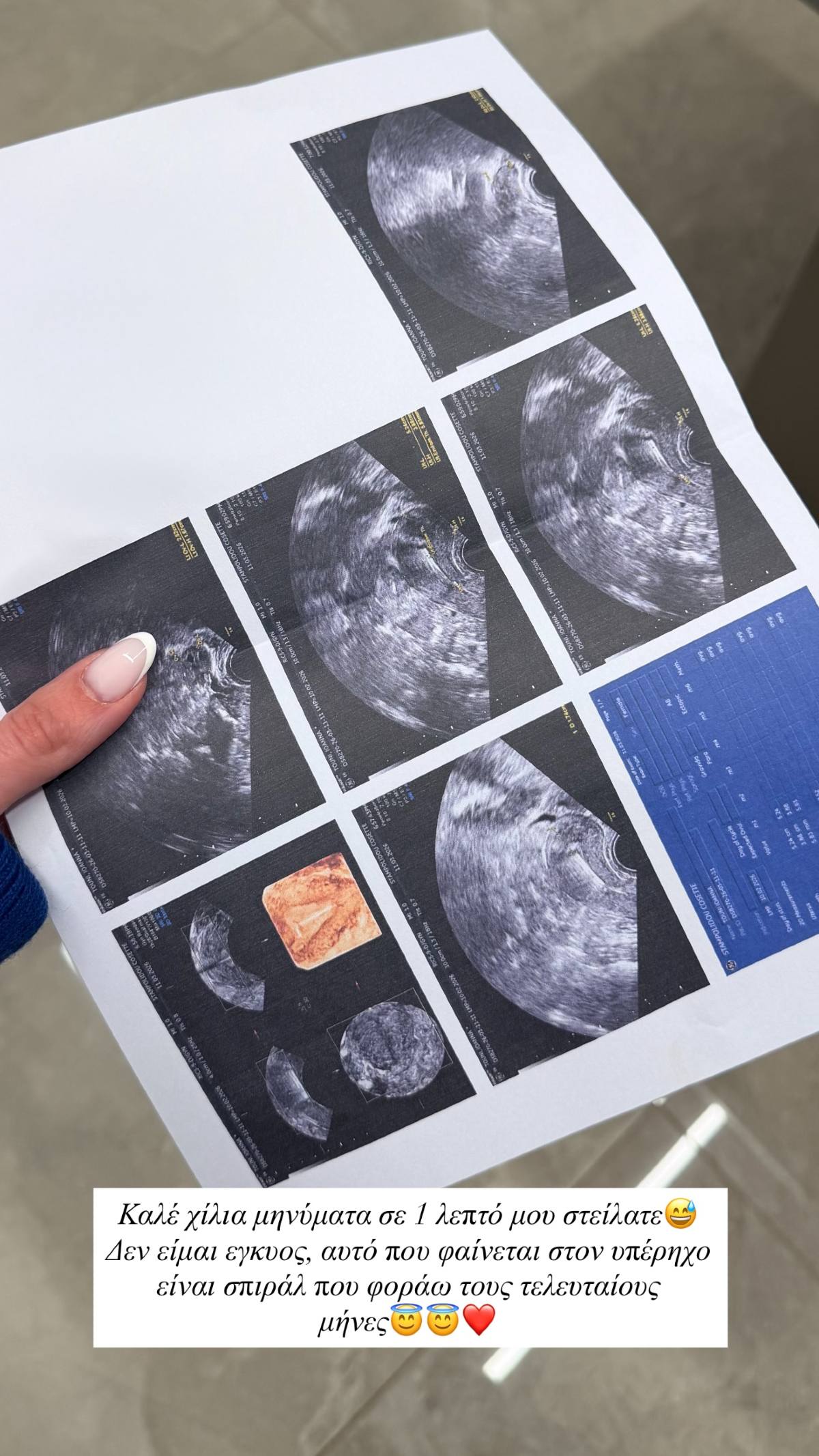 Η Ιωάννα Τούνη στον γυναικολόγο