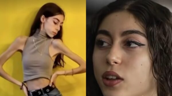 Η Έλλη για τη νευρική ανορεξία