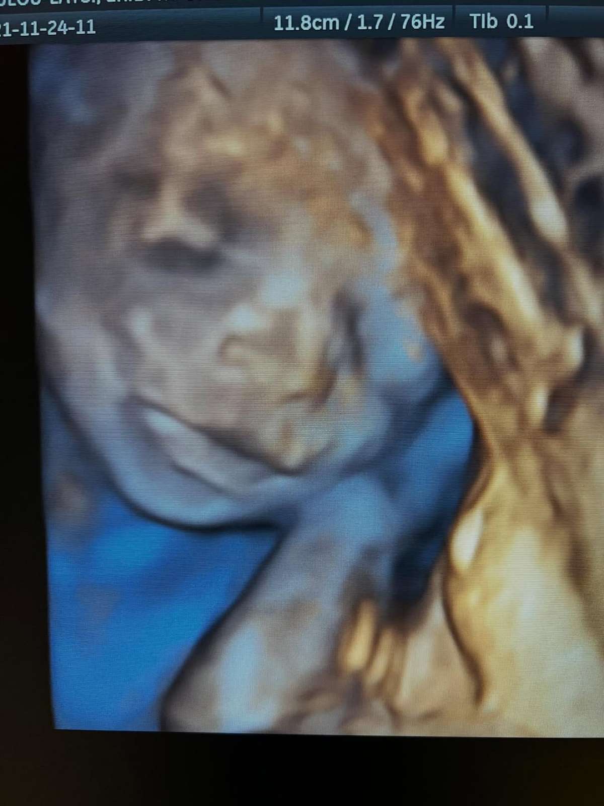 Εριέττα Κούρκουλου