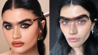 ozempic face σοφία χατζηπαντελή