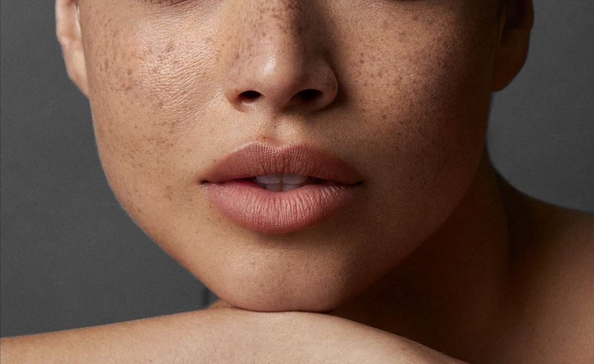 δέρμα γυναίκας 