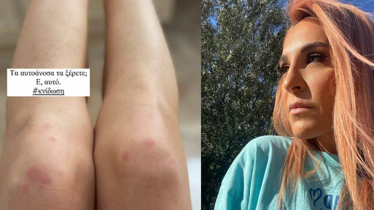 Γιάννα Τερζή αυτοάνοσο