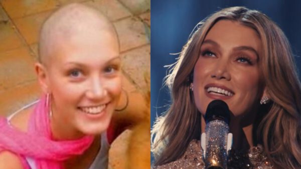 Delta Goodrem: Τι είναι το λέμφωμα Hodgkin που «χτύπησε» την εκπρόσωπο της Αυστραλίας στα 18 της - Ο γάμος υπερπαραγωγή το 2025 στην Μάλτα (Φωτογραφίες)
